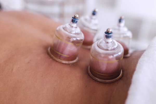Bańki chińskie popularnym naturalnym zabiegiem
